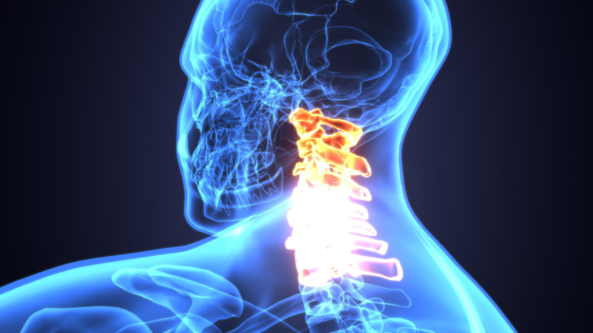 Life Post Major Motor Vehicle Accident: What Type of Rehabilitation Will I Need Following a Spinal Cord Injury?